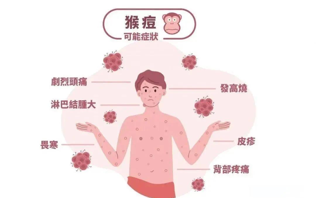 【疫情的预防措施/预防疫情的主要措施】 【疫情的预防措施/预防疫情的主要措施】